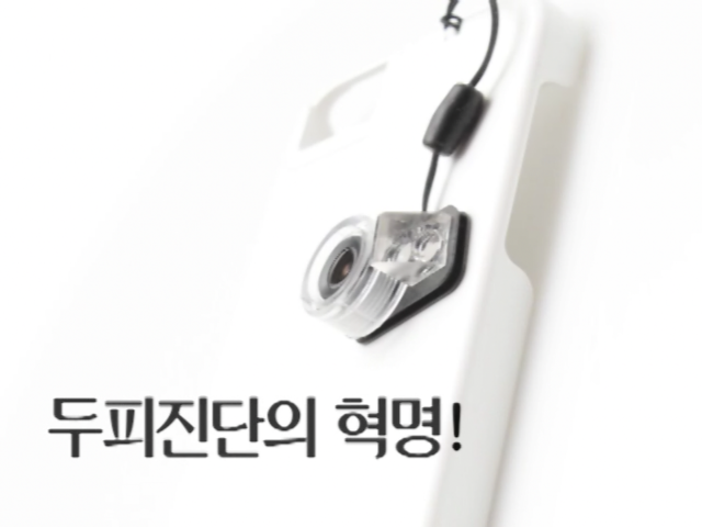 [TV헤어]스마트스코프 동영상 첨부 이미지